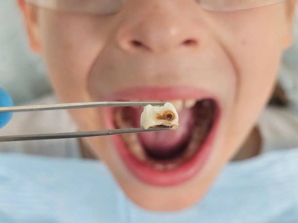 Best Cracked Tooth Emergency Dentist  in Prosser, WA